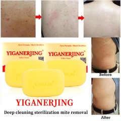 YIGANERJING Classic Sulphur Soap 84g: With a unique sulphur formula, this yellow soap deeply cleanses and effectively fights acne and excess oil.