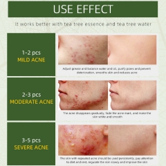 30g Yiganerjing Anti Acne Cream Chinese Herbal Pimples Blackhead Removal Cream Acne Treatment Gel