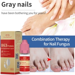 YIGANERJING 863 Nail Growth Serum - 15ml, formulated to complement 368 Nail Fungus Solution, offers antibacterial, reparative, and therapeutic benefits for healthier and visually appealing nails.